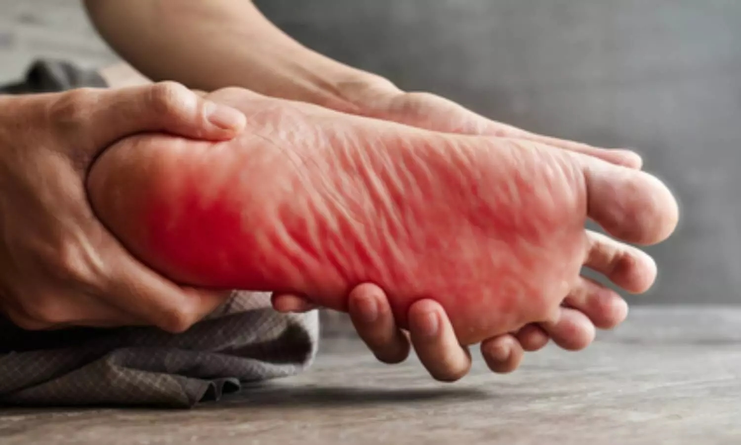 बर्निंग फीट सिंड्रोम, पैरों की जलन के पीछे बड़े कारण, गंभीर बीमारियों का भी खतरा बर्निंग फीट सिंड्रोम, पैरों की जलन के पीछे बड़े कारण, गंभीर बीमारियों का भी खतरा