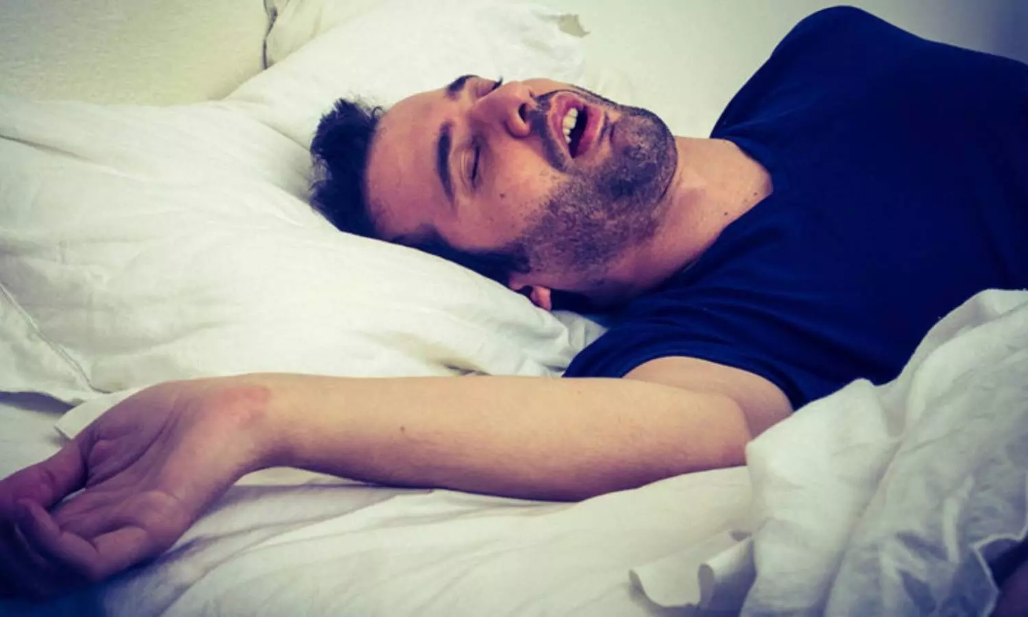 Sleep Apnea Alert: क्या सोते समय आपकी भी फूलती है सांस? स्लीप एप्निया से 71 प्रतिशत बढ़ जाता है हार्ट अटैक का खतरा