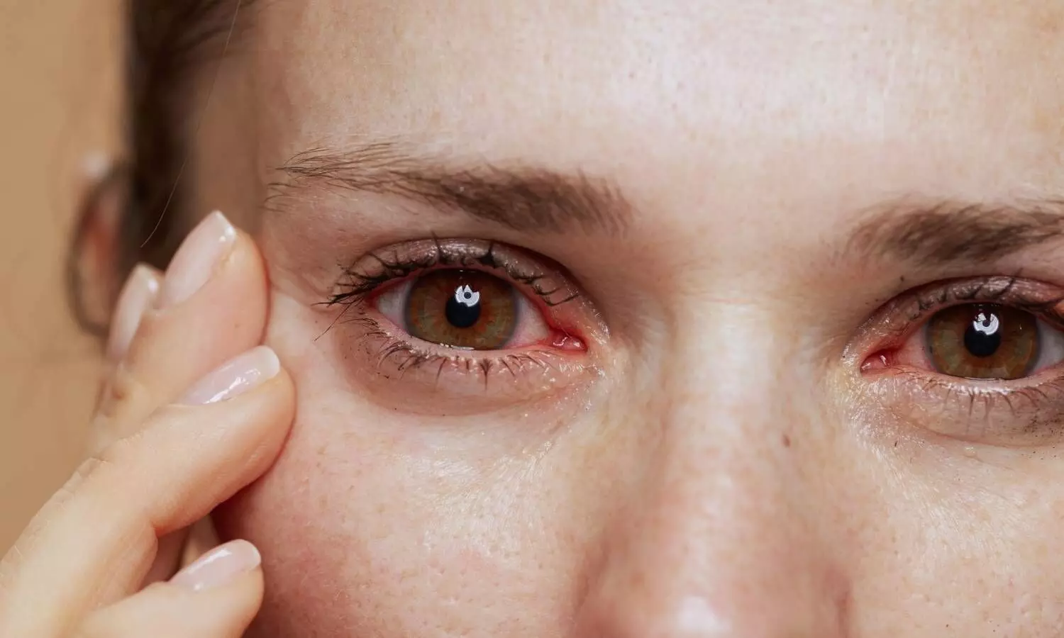 AIIMS Dry Eye Treatment: अब आई ड्रॉप्स की जरूरत नहीं! एम्स ने खोजी मां के दूध वाले प्रोटीन से बनी टैबलेट, मिटाएगी आंखों का सूखापन AIIMS Dry Eye Treatment: अब आई ड्रॉप्स की जरूरत नहीं! एम्स ने खोजी मां के दूध वाले प्रोटीन से बनी टैबलेट, मिटाएगी आंखों का सूखापन