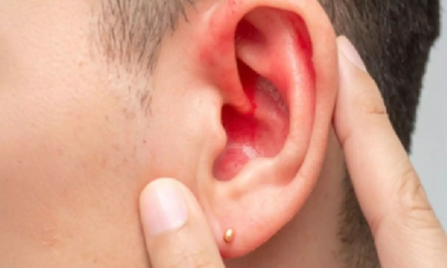 अदरक और सेंधा नमक का तेल: कान दर्द में राहत, प्रयोग से पहले जानें सावधानियां अदरक और सेंधा नमक का तेल: कान दर्द में राहत, प्रयोग से पहले जानें सावधानियां